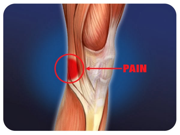 Pain Behind Knee