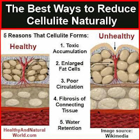 hover_share weight loss - best ways to reduce cellulite naturally