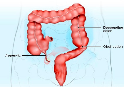 appendix