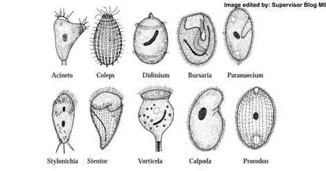 Protozoa berikut yang memiliki bentuk tubuh seperti terompet adalah