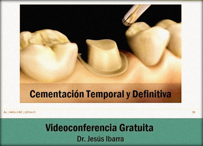 PRÓTESIS DENTAL: Cementación temporal y definitiva - Videoconferencia del Dr. Jesús Ibarra