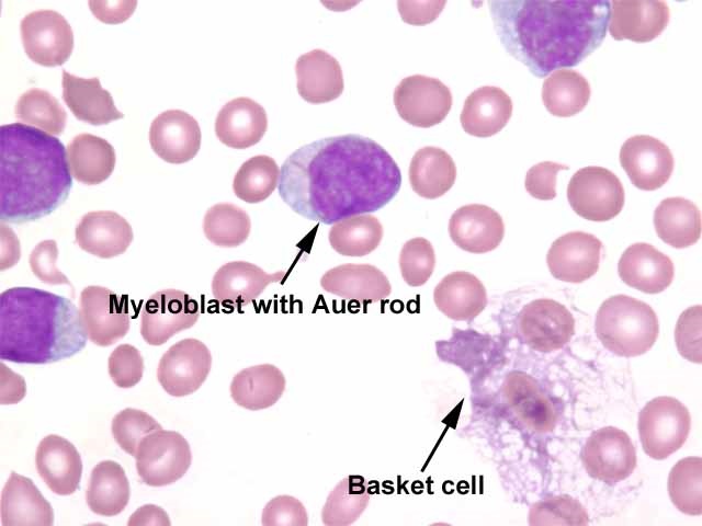 Lecture Notes in Medical Technology: Lecture #9 : The White Blood Cells