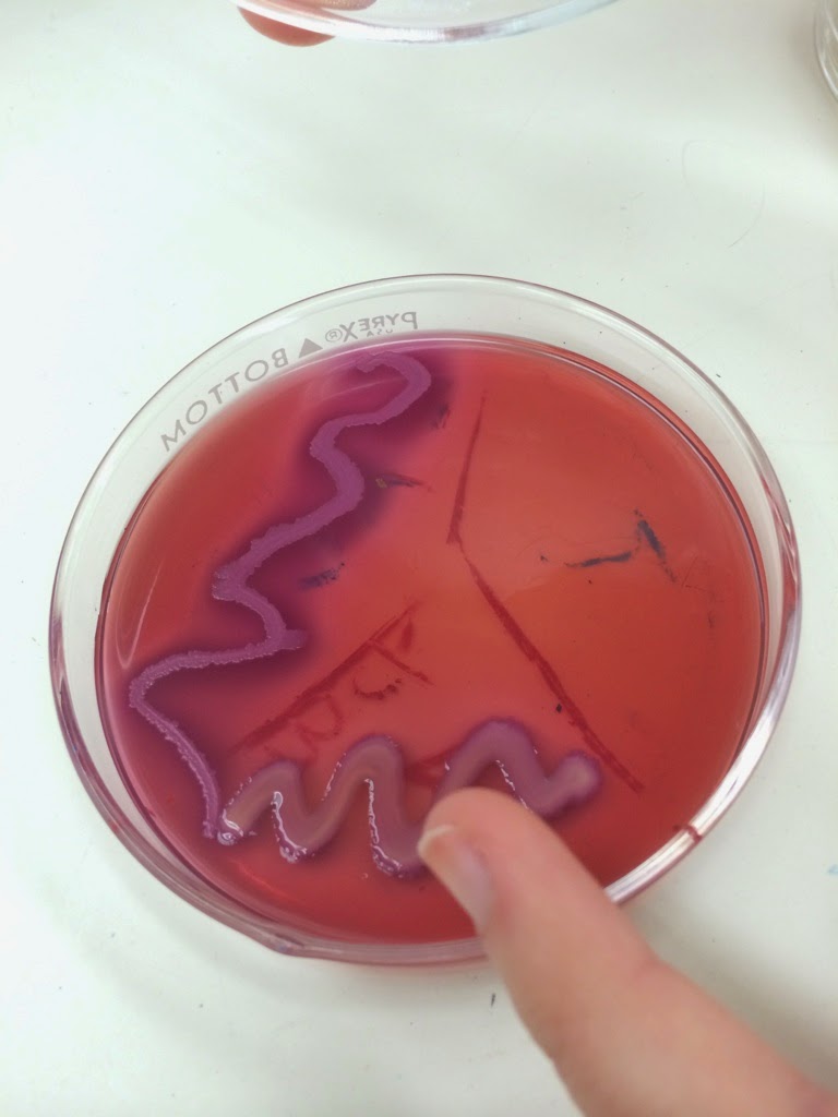 Getting Bacteria Samples