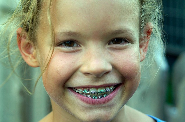 The Wilmington Braces Blog: Kids getting braces at a younger age