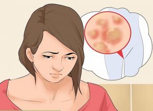 Nama Obat Sipilis 3hari Sembuh Nama Obat Sipilis 3hari Sembuh