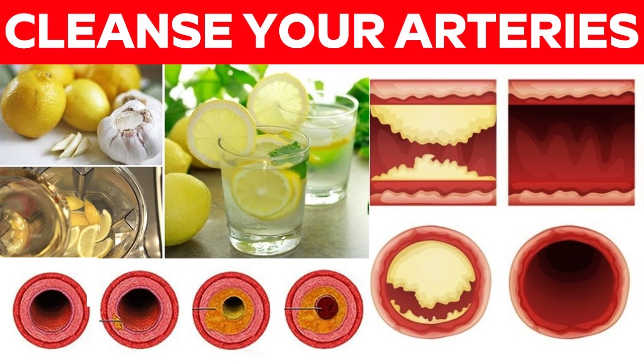 10 Foods That Naturally Open Your Arteries