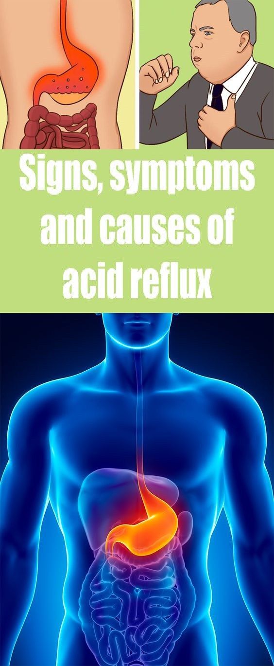 signs-symptoms-causes-of-acid-reflux-stylelos