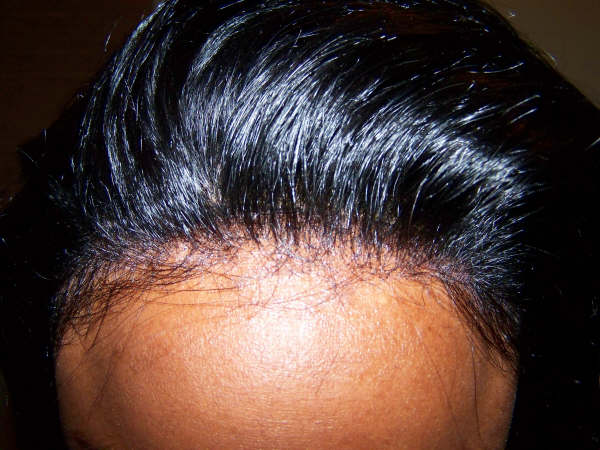 perruques indétectables front lace wig