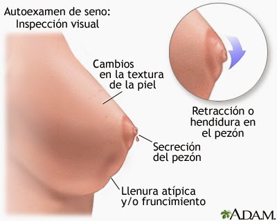 De no mama cancer duele el