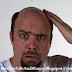Home Remedies For Get Hair Again