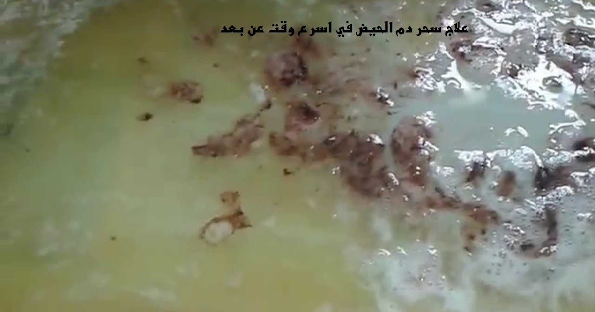 علاج السحر المشروب أو أكل دم الحيض