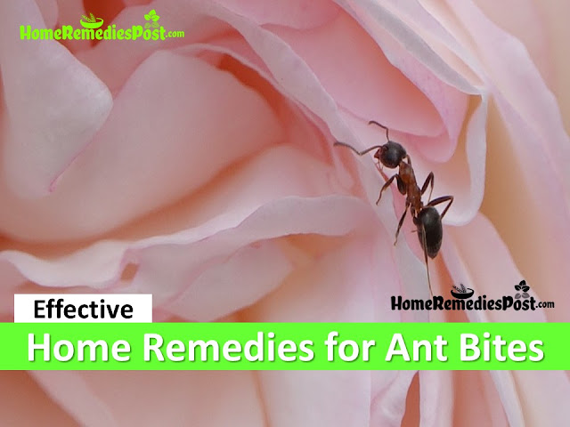 How to Get Rid Of Ant Bites, Home Remedies For Ant Bites, Ant Bite Relief, Ant Bites Treatment, How To Treat Ant Bites Fast, How To Cure Ant Bites and stings, pest control, Ant Bites Home Remedies, Ant Bite Remedies, Remedies For Ant Bites, Cure Ant Bites, Treatment For Ant Bites, Best Ant Bites Treatment, How To Get Relief From Ant Bites, Relief From Ant Bites, How To Get Rid Of Ant Bites Fast,