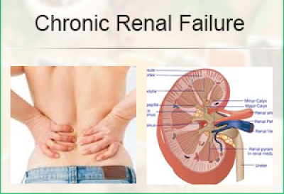 Ramdev Products For Chronic Renal Failure
