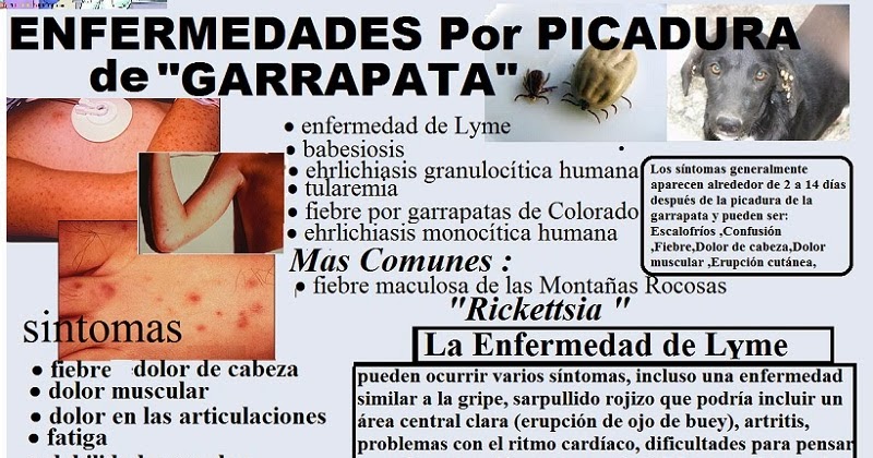 enfermedad por picadura de garrapata en humanos enfermedad por picadura de garrapata en humanos