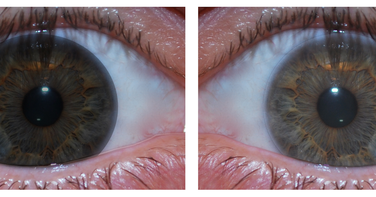 Matheson Optometrists Blog Transitions Contact lenses arriving in the UK!