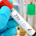 Saúde: Pela primeira vez, cientistas italianos isolam vírus Zika na saliva