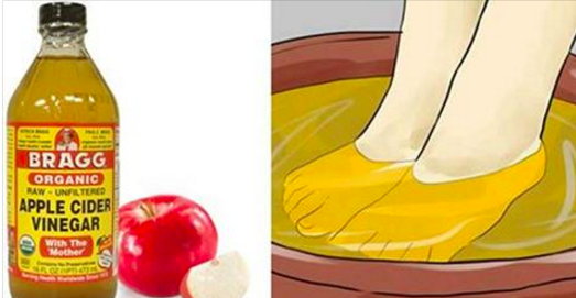 10 nouvelles utilisations du vinaigre de cidre ! Incroyable !