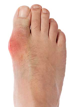 Best Tennis Shoes For Bunion Pain Best Tennis Shoes For Bunion Pain
