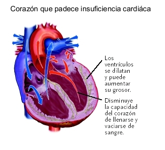 Presión sistólica elevada de la arteria pulmonar icd 10