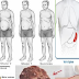 Signs Of A Fatty Liver That Could Put Your Life In Danger