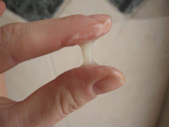 Penyebab Keputihan Gatal Bau Dan Berwarna