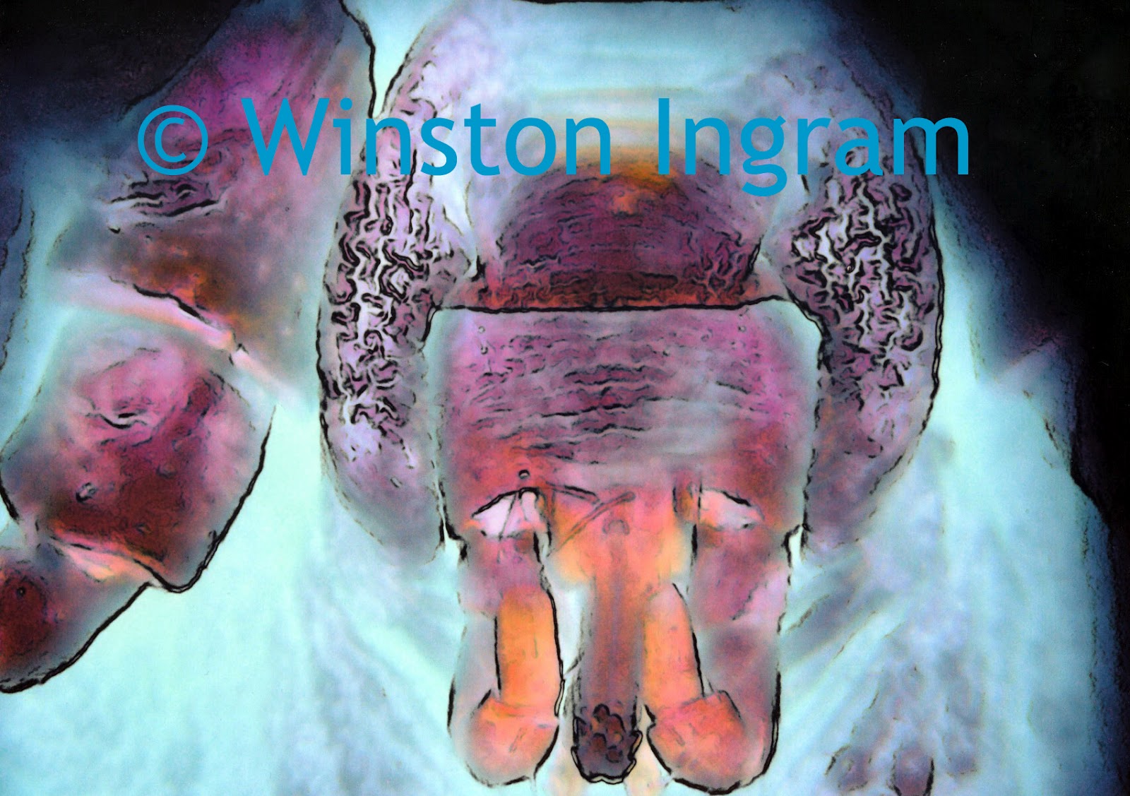 Microscope World Blog Bed Bugs Under the Microscope