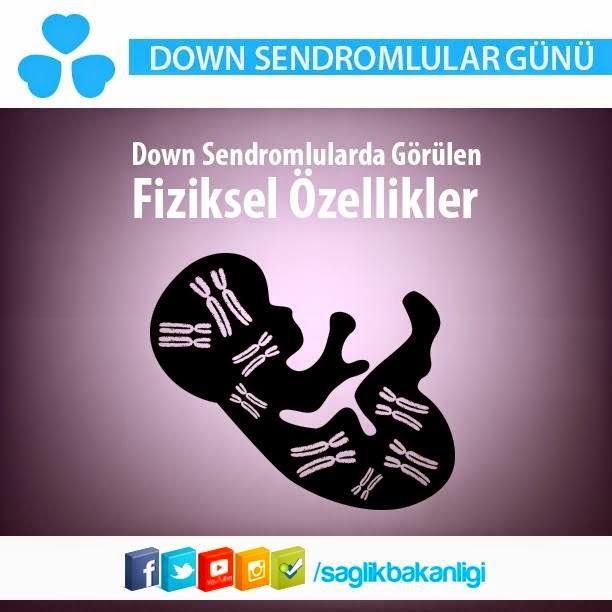 Down Sendromlular Günü Yunus Emre ASM