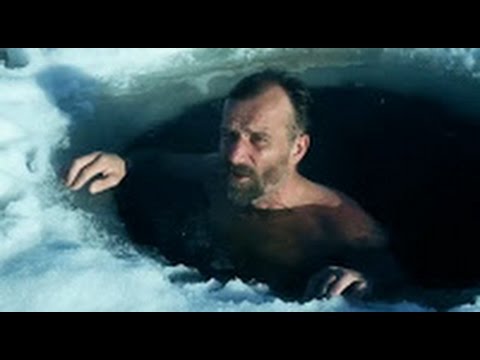 Woow Kelainan dan beberapa fakta manusia unik di dunia Woow Kelainan dan beberapa fakta manusia unik di dunia