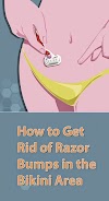 How To Get Rid of Razor Bumps in The Bikini Area