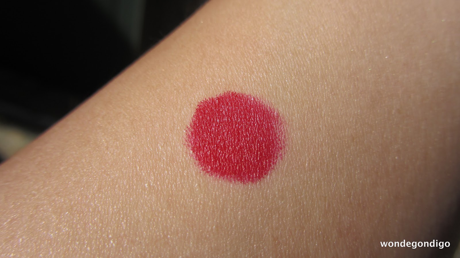 Perfect Red Circle On Skin Pictures to Pin on Pinterest 
