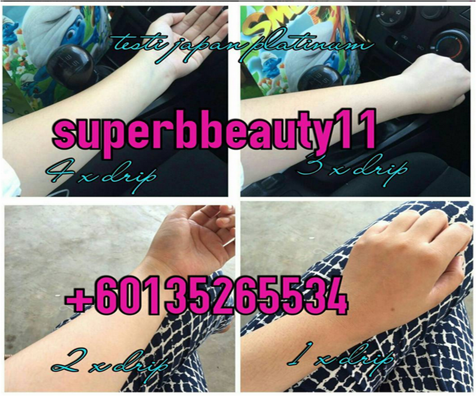 Every Girl Deserves To Be Pretty 2 TESTIMONI JAPAN PLATINUM WHITENING