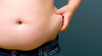 Penelitian Terbaru : Obesitas Berkaitan dengan 8 Jenis Kanker