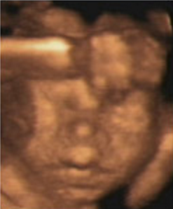 Hafta hafta bebeğin ultrason görüntüleri-23.hafta