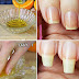 Natural Home Remedies For Nail Growth Fast And Effectively