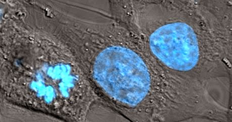 Featured image of post Nucleoplasma