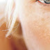 Dyschromia Definition, Symptoms, Causes, Treatment