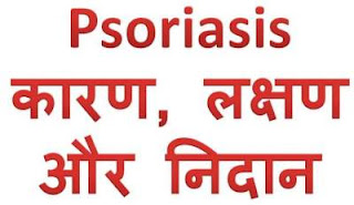 psoriasis-karan-lakshan-upchar-hindi