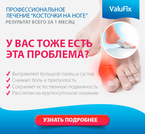 Лечение косточки над пяткой. Упражнения от косточки на большом пальце ноги – эффективные методы лечения Боль в пятке. Пяточная шпора. Компресс для снятия боли. Как лечить пяточную шпору! Лечение косточек на ногах йодом и аспирином (отзывы и мнения).