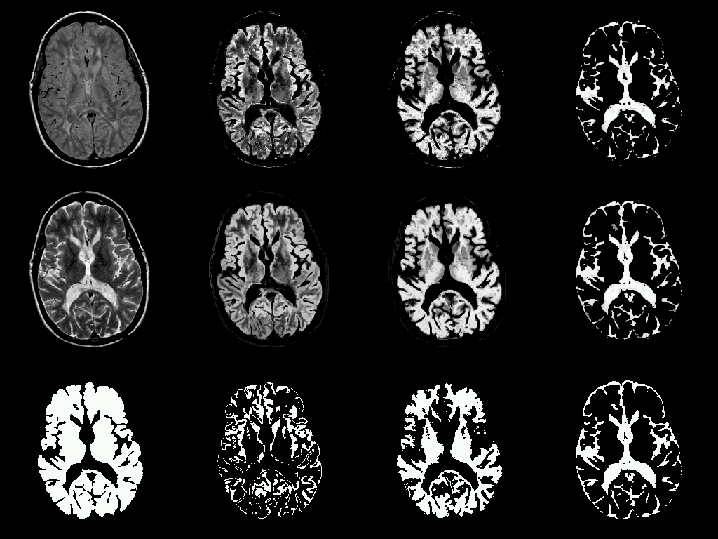 O2.0 hyperbaric oxygen therapy news New on HyperbaricLink Vascular