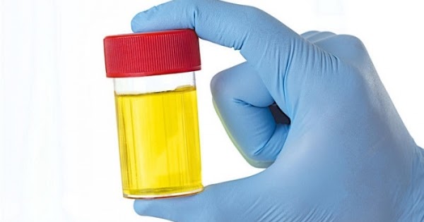 Kidney Disease Treatment and Diet: What does Blood 3+ in Urine Mean in
