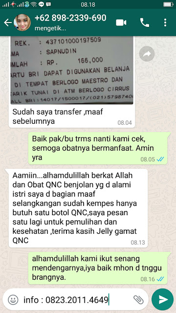 obat benjolan dibawah lidah obat benjolan dibawah lidah