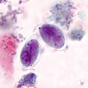 giardia lamblia it is survive in cold water)