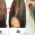 Powerful Hair Fall Treatment at Home That Is Surely Effective!