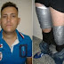 DNCD apresa cubano viajaría a España con piernas forradas de cocaína