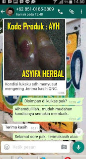 Obat Luka Bakar Herbal