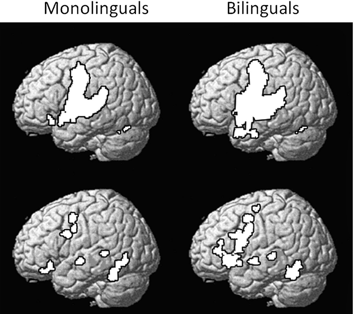Видите третьего альпиниста старость мозга. Старение мозга. Знание иностранных языков замедляет старение мозга. Японский тест на старение мозга ответы. Тест на старение мозга картинки.