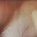 VIDEO. Al C. IATROPOLIS epilazione e depilazione DEFINITIVA col laser a diodo. GUARDATE