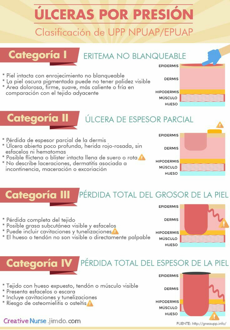 Cuidados y Tecnicas de Enfermería ÚLCERAS POR PRESIÓN (CLASIFICACIÓN). Cuidados y Tecnicas de Enfermería ÚLCERAS POR PRESIÓN (CLASIFICACIÓN).