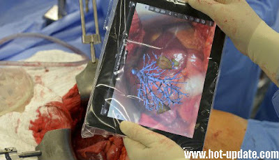 Mengagumkan, Tablet dapat digunakan dalam Operasi