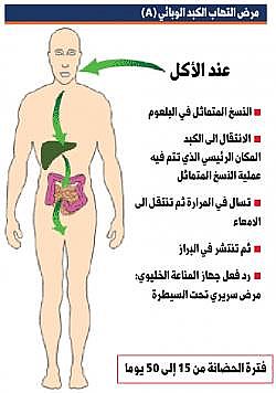 اعراض التهاب الكبد